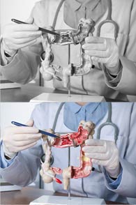 Colorectal Surgery provided by Jihan Hegazy, MD, FACS - Modesto General Surgeon  - Minimally Invasive Surgery 